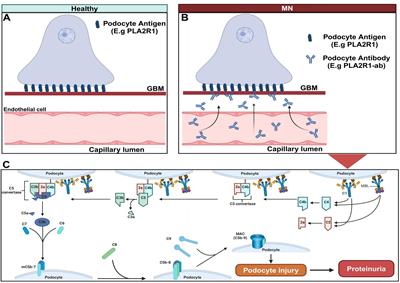 Animal models of membranous nephropathy: more choices and higher similarity